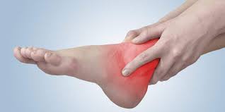 Leg Pain